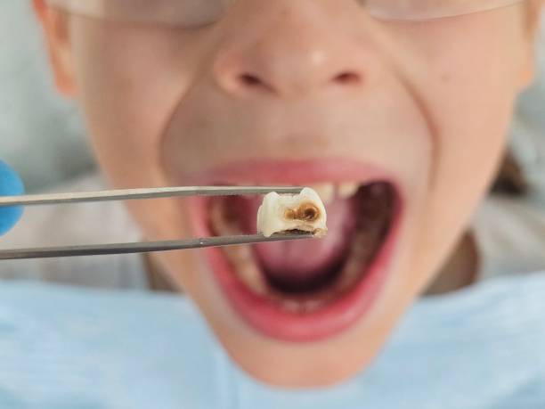 Best Pediatric Emergency Dentist in Southgate, MI